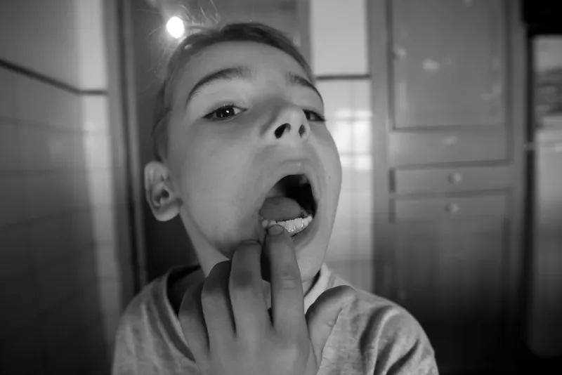Sweet Medicine, Bitter Consequences: How Your Child's Liquid Prescription Could Be Quietly Damaging Their Teeth